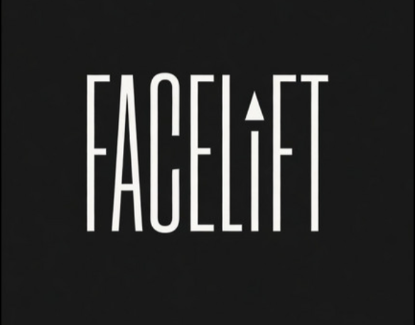 Facelift
